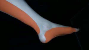 neuromuscular