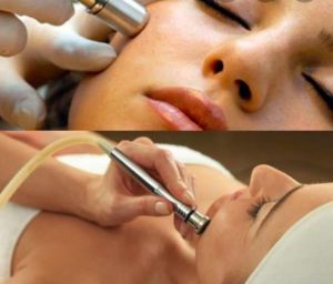 Promocion octubre tratamientos estéticos tratamiento facial con punta de diamante Reus
